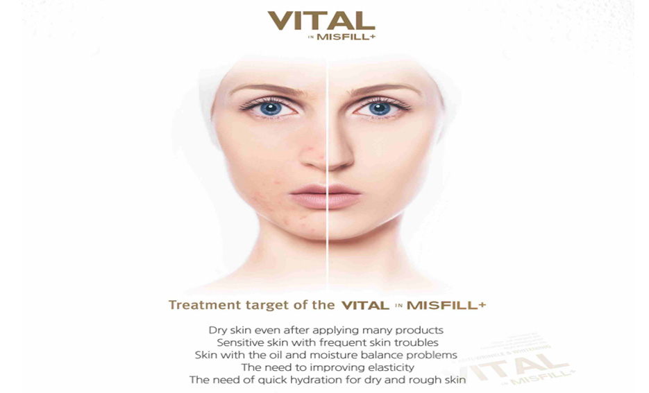 مزوژل آبرسان ویتال میس فیل Vital Misfill