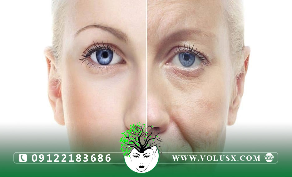مزوژل آبرسان و جوانساز ویتال